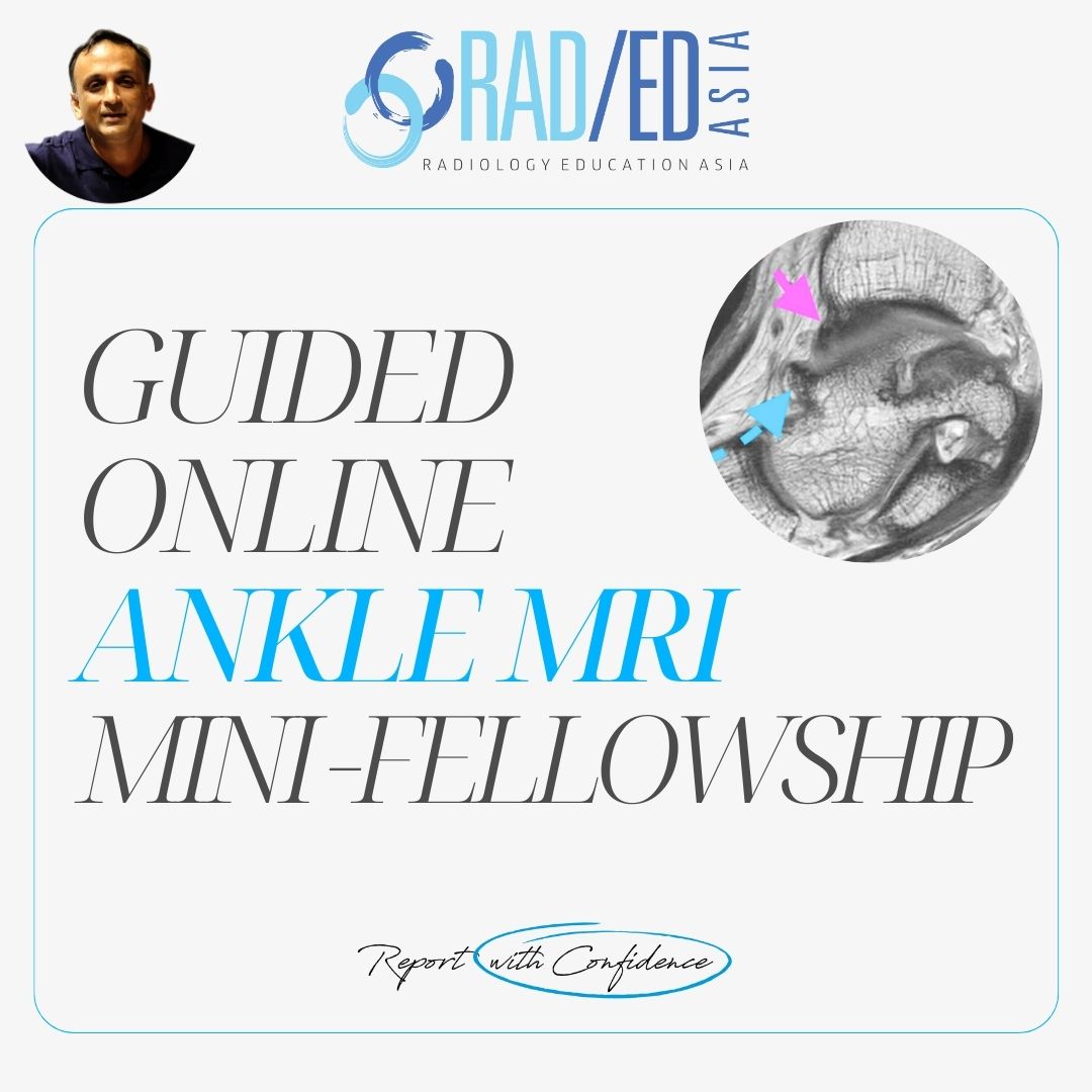 ankle-mri-msk-online-musculoskeletal-course-learn-radiology-imaging-radedasia