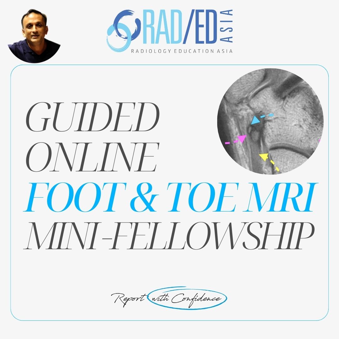 foot-toe-msk-ankle-mri-online-musculoskeletal-course-learn-radiology-imaging-radedasia