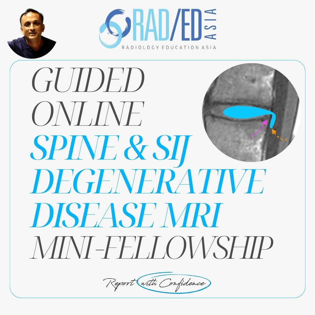 spine-sij-degeneration-mri-online-course-learn-radiology-imaging-ct-xray-radedasia (1)