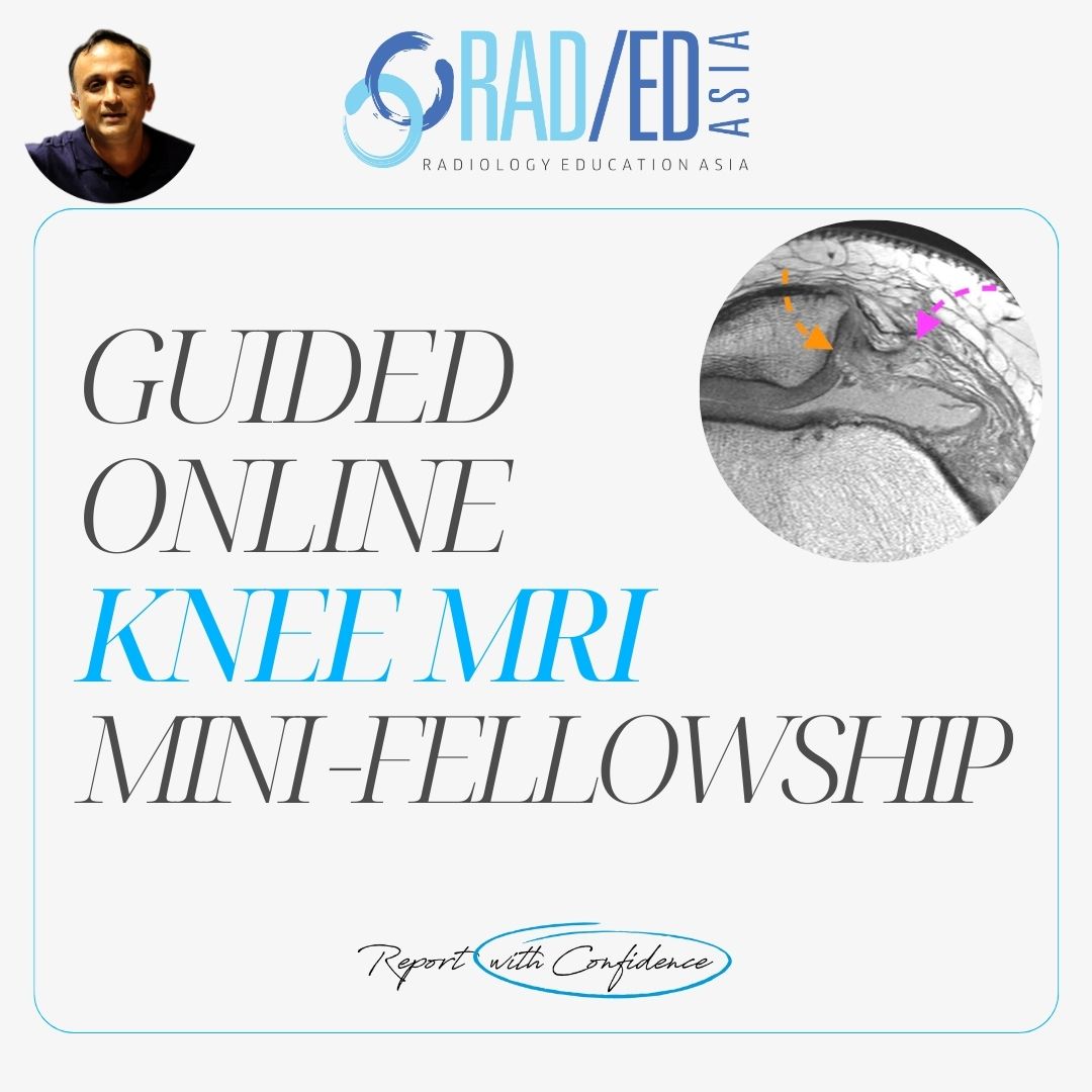 knee mri msk online musculoskeletal course learn radiology imaging radedasia