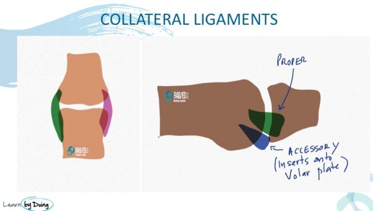 Finger collateral ligaments radedasia radiology education asia