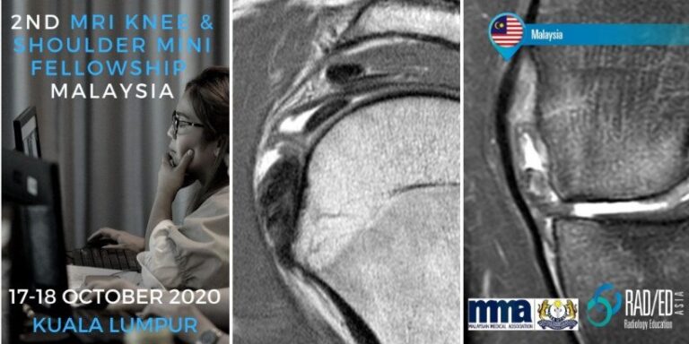 KLKS20Oct kuala lumpur malaysia mri knee shoulder mini fellowship workshop radiology conference