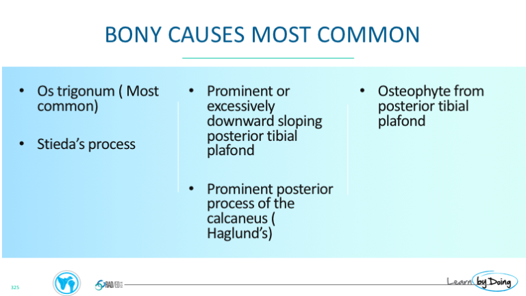 ankle impingement posterior bony causes radiology education asia