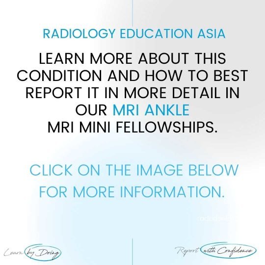 ankle msk mri learn radiology online course radedasia