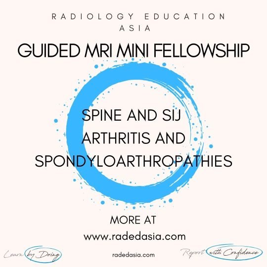 learn mri radiology spine spondyloarthtopathy radedasia