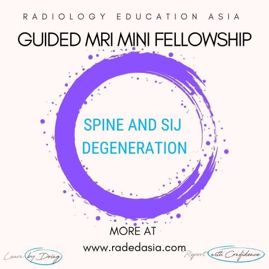 learn mri spine degen radiology online radedasia