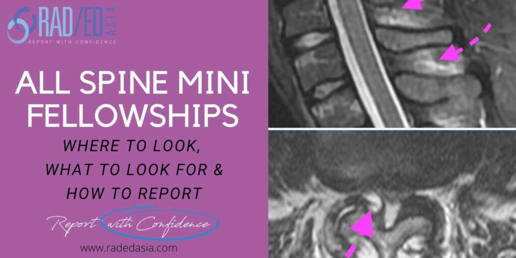 learn spine imaging mri ct xray radiology conference course trauma anatomy degeneration arthritis