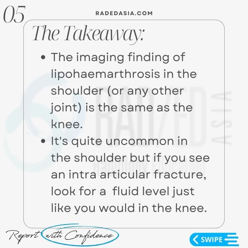 lipohemarthrosis shoulder radiology trauma xray radedasia