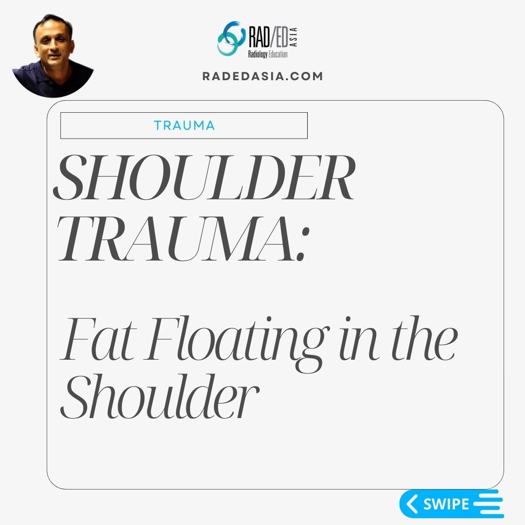 lipohemarthrosis shoulder xray trauma radedasia