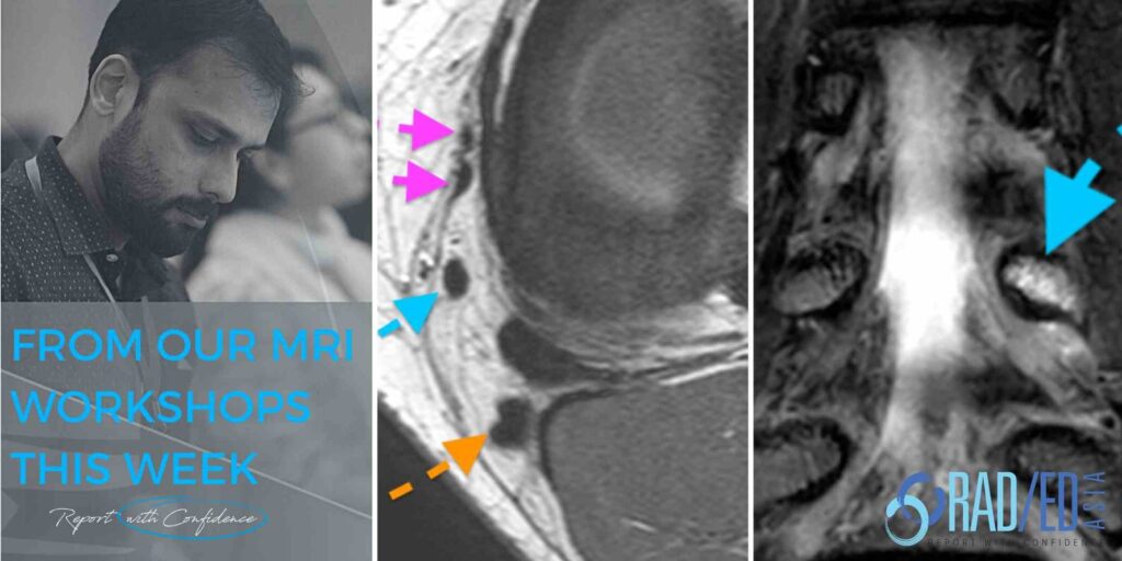 msk mri course radiology online radedasia