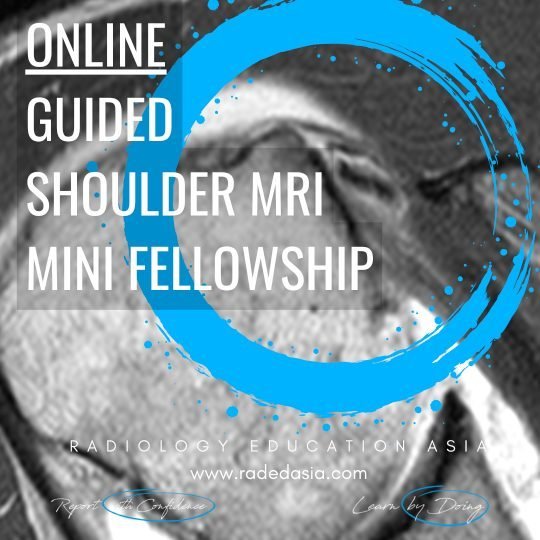 msk radiology guided online mri shoulder radiology