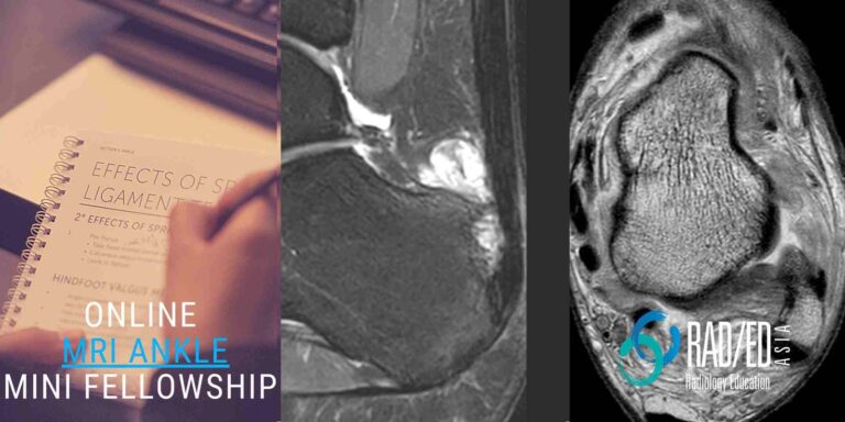 online radiology course mri ankle radedasia