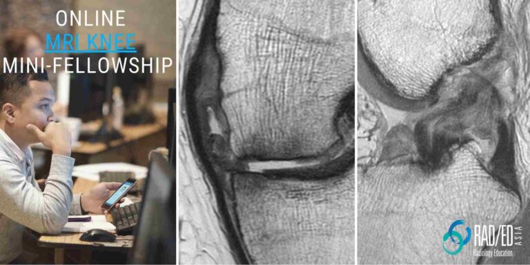 online radiology course mri knee radedasia