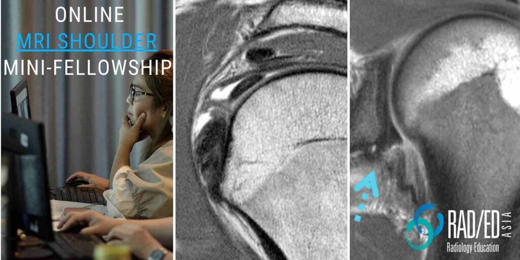 online radiology course mri shoulder radedasia