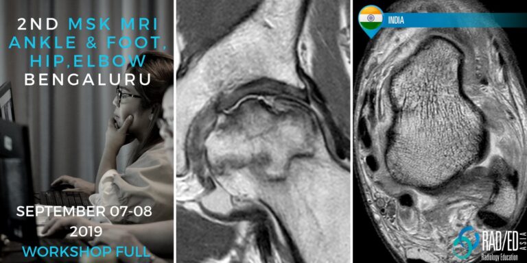 radiology conference 2nd bangalore india mri fellowship hip ankle elbow radedasia