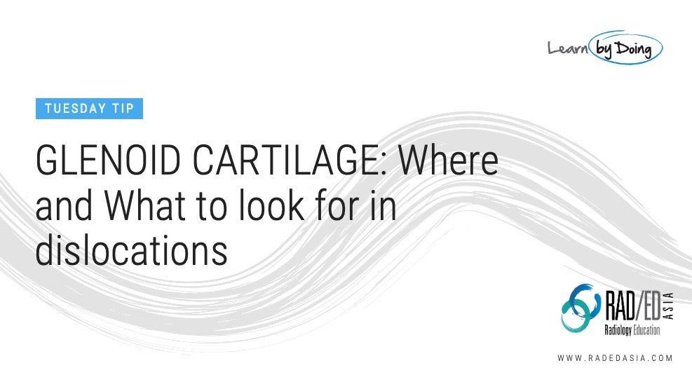 shoulder-cartilage-glenoid-dislocation