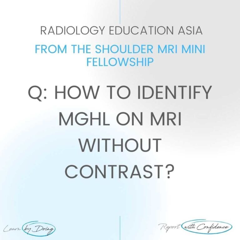 shoulder ligament mghl mri tear middle glenohumeral radedasia