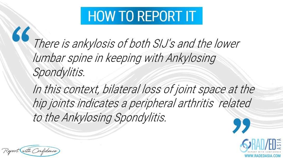 ankylosing-spondylitis-hip-involvement-imaging-xray-report-radedasia.jpg