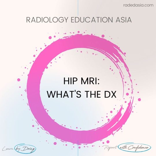 learn-mri-radiology-hip-intro-circle-radedasia.jpg