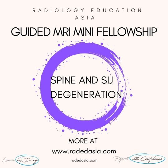 learn-mri-radiology-spine-degen-radedasia.jpg