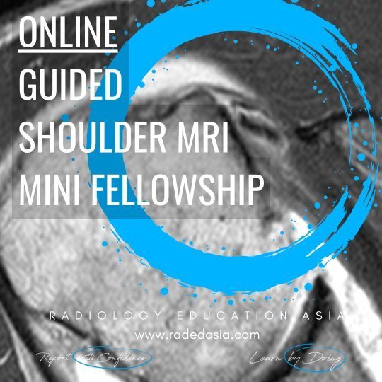 msk-radiology-guided-online-mri-shoulder-radiology.jpg