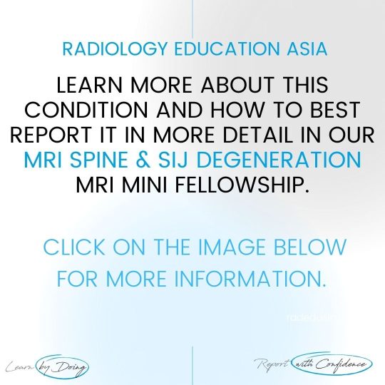 spine-sij-degen-mri-learn-radiology-online-course-radedasia.jpg