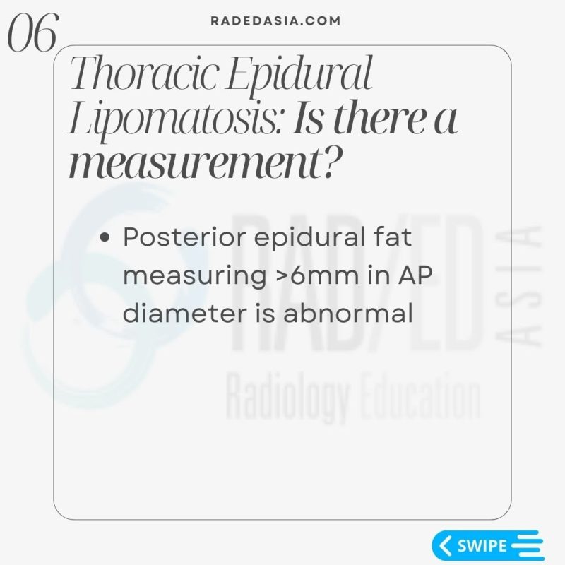 thoracic-epidural-lipomatosis-radiology-spinal-spine-mri-radedasia.jpg